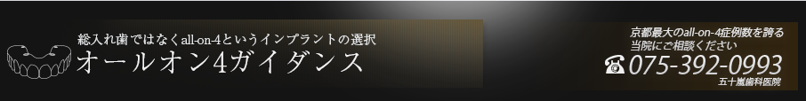 オールオン4ガイダンス - 総入れ歯ではなくall-on-4というインプラントの選択